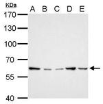 GGT1 Antibody in Western Blot (WB)