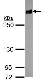 Filamin B Antibody in Western Blot (WB)