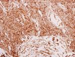 Filamin B Antibody in Immunohistochemistry (Paraffin) (IHC (P))