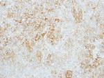 GBA Antibody in Immunohistochemistry (Paraffin) (IHC (P))