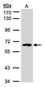 GBA Antibody in Western Blot (WB)