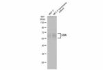 GBA Antibody in Western Blot (WB)