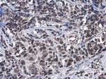 ATRX Antibody in Immunohistochemistry (Paraffin) (IHC (P))