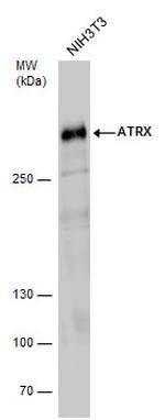 ATRX Antibody in Western Blot (WB)