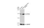 ATP5D Antibody in Western Blot (WB)