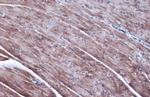 ODC1 Antibody in Immunohistochemistry (Paraffin) (IHC (P))