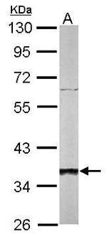 SGTA Antibody in Western Blot (WB)