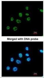 PAX8 Antibody in Immunocytochemistry (ICC/IF)