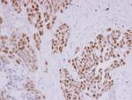 PAX8 Antibody in Immunohistochemistry (Paraffin) (IHC (P))