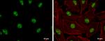 ADAR1 Antibody in Immunocytochemistry (ICC/IF)