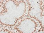 ADAR1 Antibody in Immunohistochemistry (Paraffin) (IHC (P))