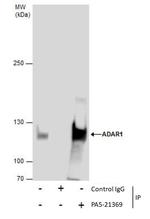 ADAR1 Antibody in Immunoprecipitation (IP)