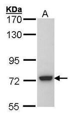 SGSH Antibody in Western Blot (WB)