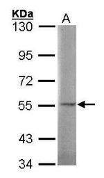 SGSH Antibody in Western Blot (WB)