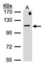 beta-1 Adaptin Antibody in Western Blot (WB)