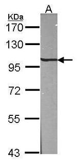 beta-1 Adaptin Antibody in Western Blot (WB)