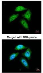 CtBP1 Antibody in Immunocytochemistry (ICC/IF)