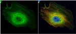 ENO1 Antibody in Immunocytochemistry (ICC/IF)