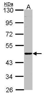 ENTPD6 Antibody in Western Blot (WB)