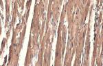 alpha-Cardiac Actin Antibody in Immunohistochemistry (Paraffin) (IHC (P))