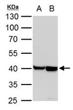 alpha-Cardiac Actin Antibody in Western Blot (WB)