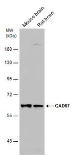 GAD67 Antibody in Western Blot (WB)