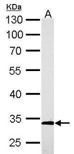 ARPC2 Antibody in Western Blot (WB)