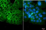 CD44 Antibody in Immunocytochemistry (ICC/IF)