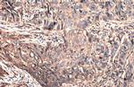 CD44 Antibody in Immunohistochemistry (Paraffin) (IHC (P))