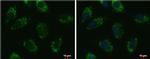 UQCRFS1 Antibody in Immunocytochemistry (ICC/IF)