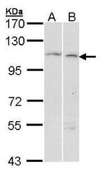 GANAB Antibody in Western Blot (WB)