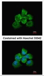 ARHGEF18 Antibody in Immunocytochemistry (ICC/IF)