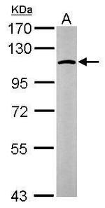 GANAB Antibody in Western Blot (WB)