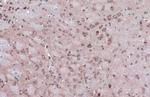 NUP62 Antibody in Immunohistochemistry (Paraffin) (IHC (P))