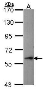 Perforin Antibody in Western Blot (WB)