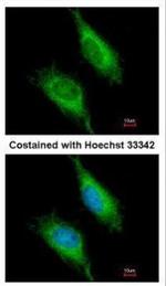 FASTK Antibody in Immunocytochemistry (ICC/IF)