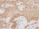 FASTK Antibody in Immunohistochemistry (Paraffin) (IHC (P))