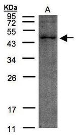 TMLHE Antibody in Western Blot (WB)