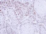 CAS Antibody in Immunohistochemistry (Paraffin) (IHC (P))