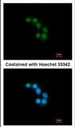 Unc18-2 Antibody in Immunocytochemistry (ICC/IF)