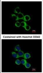 BBOX1 Antibody in Immunocytochemistry (ICC/IF)