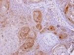 BBOX1 Antibody in Immunohistochemistry (Paraffin) (IHC (P))