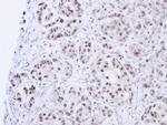 DNA Ligase III Antibody in Immunohistochemistry (Paraffin) (IHC (P))