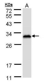 RANBP1 Antibody in Western Blot (WB)