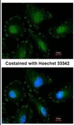 Calpain 5 Antibody in Immunocytochemistry (ICC/IF)