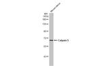 Calpain 5 Antibody in Western Blot (WB)