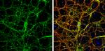 HOMER1 Antibody in Immunocytochemistry (ICC/IF)