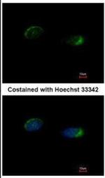 HOMER1 Antibody in Immunocytochemistry (ICC/IF)