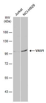 VAV1 Antibody in Western Blot (WB)