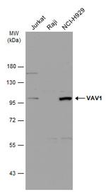 VAV1 Antibody in Western Blot (WB)